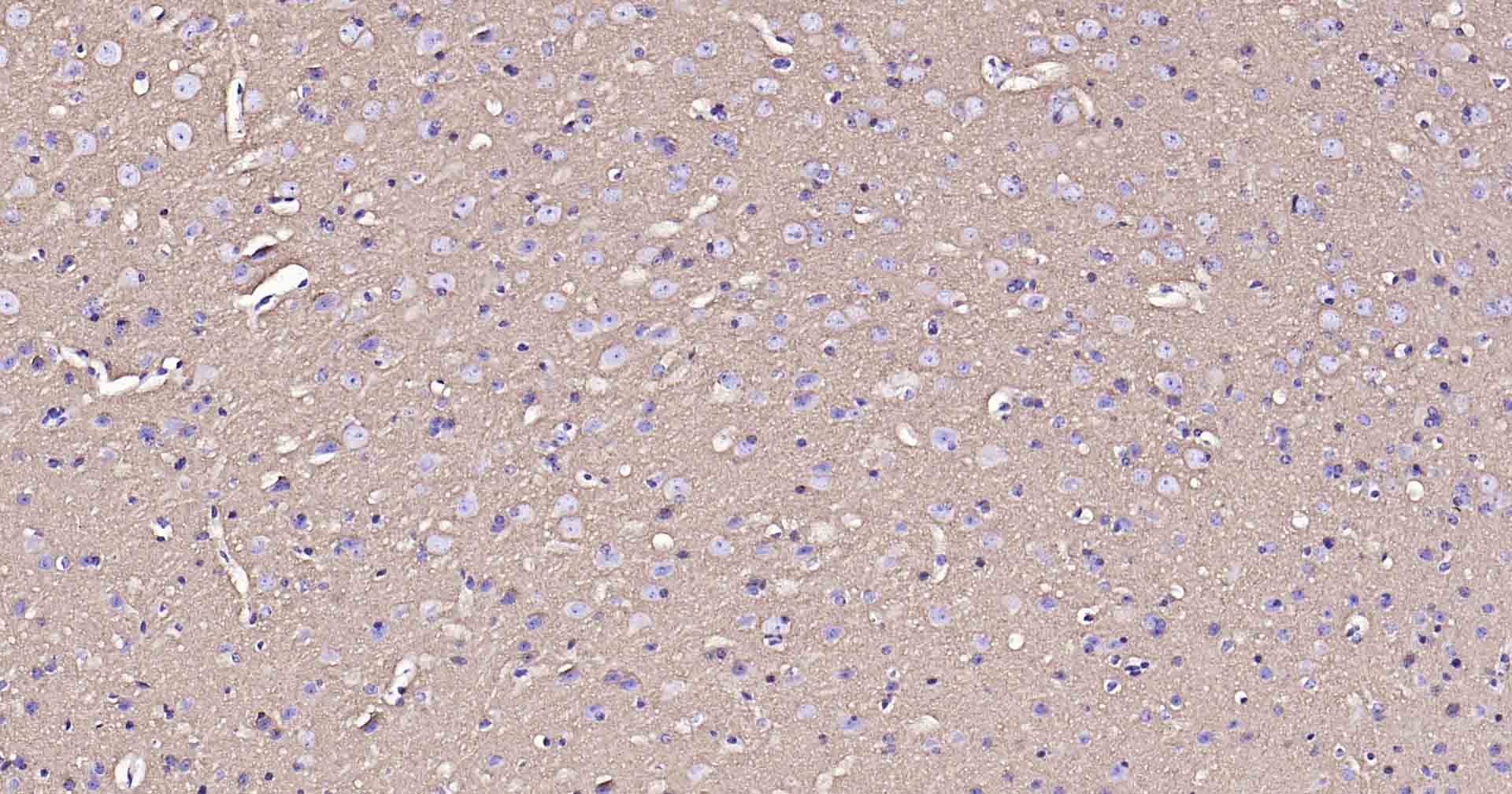 钠钾ATP酶蛋白a1单克隆抗体-bsm-34014M