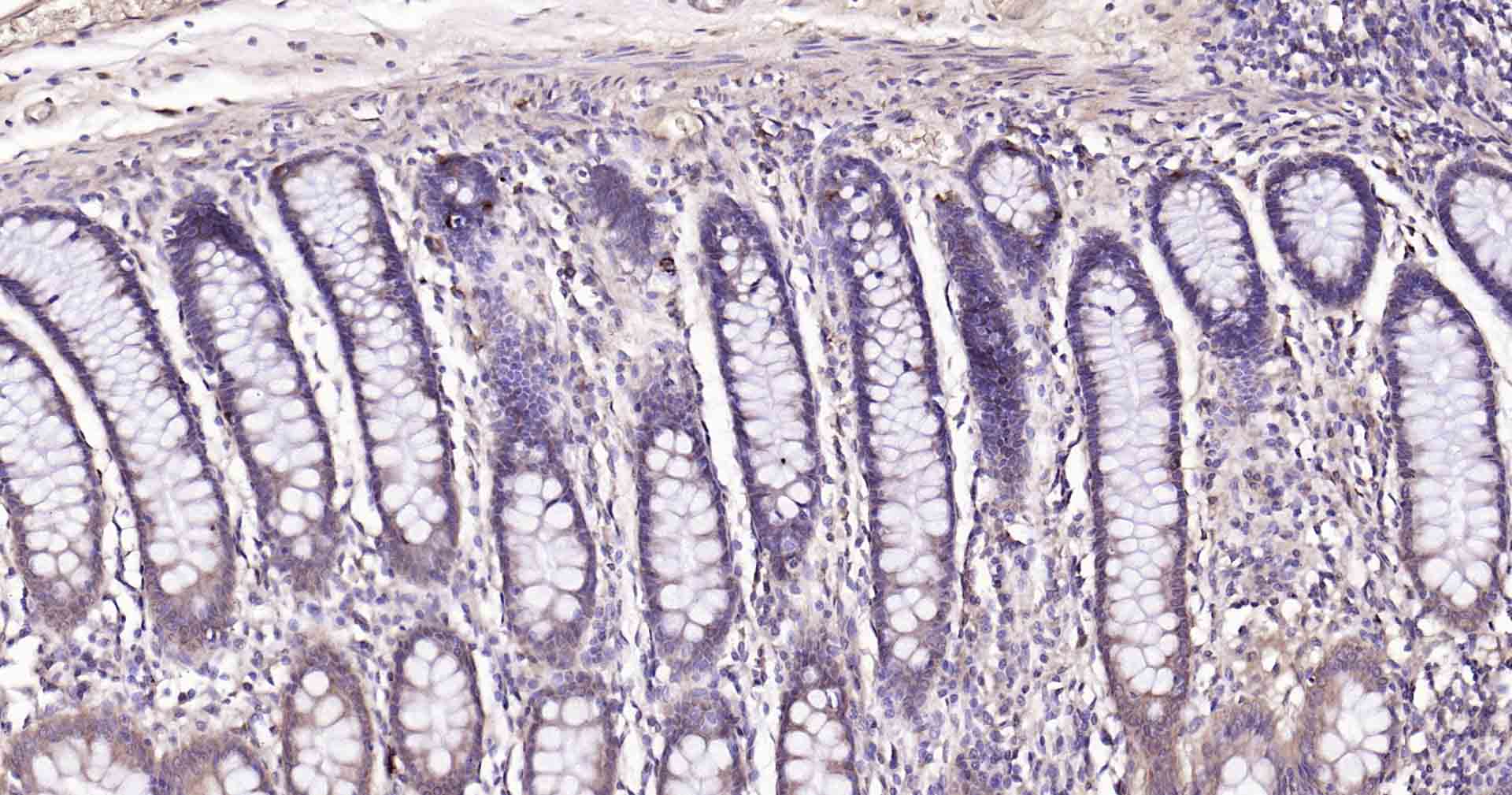 自噬效应蛋白Beclin 1重组兔单抗