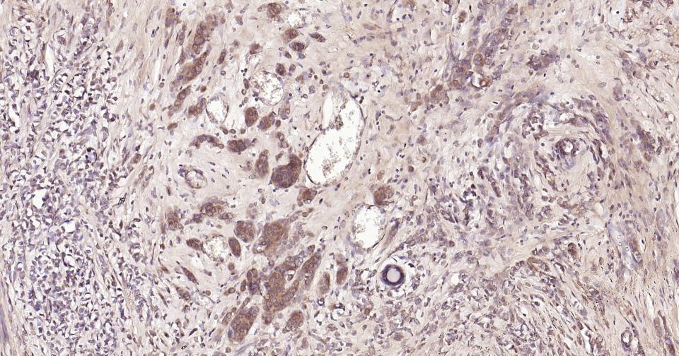 GADD153抗体-bs-1361R