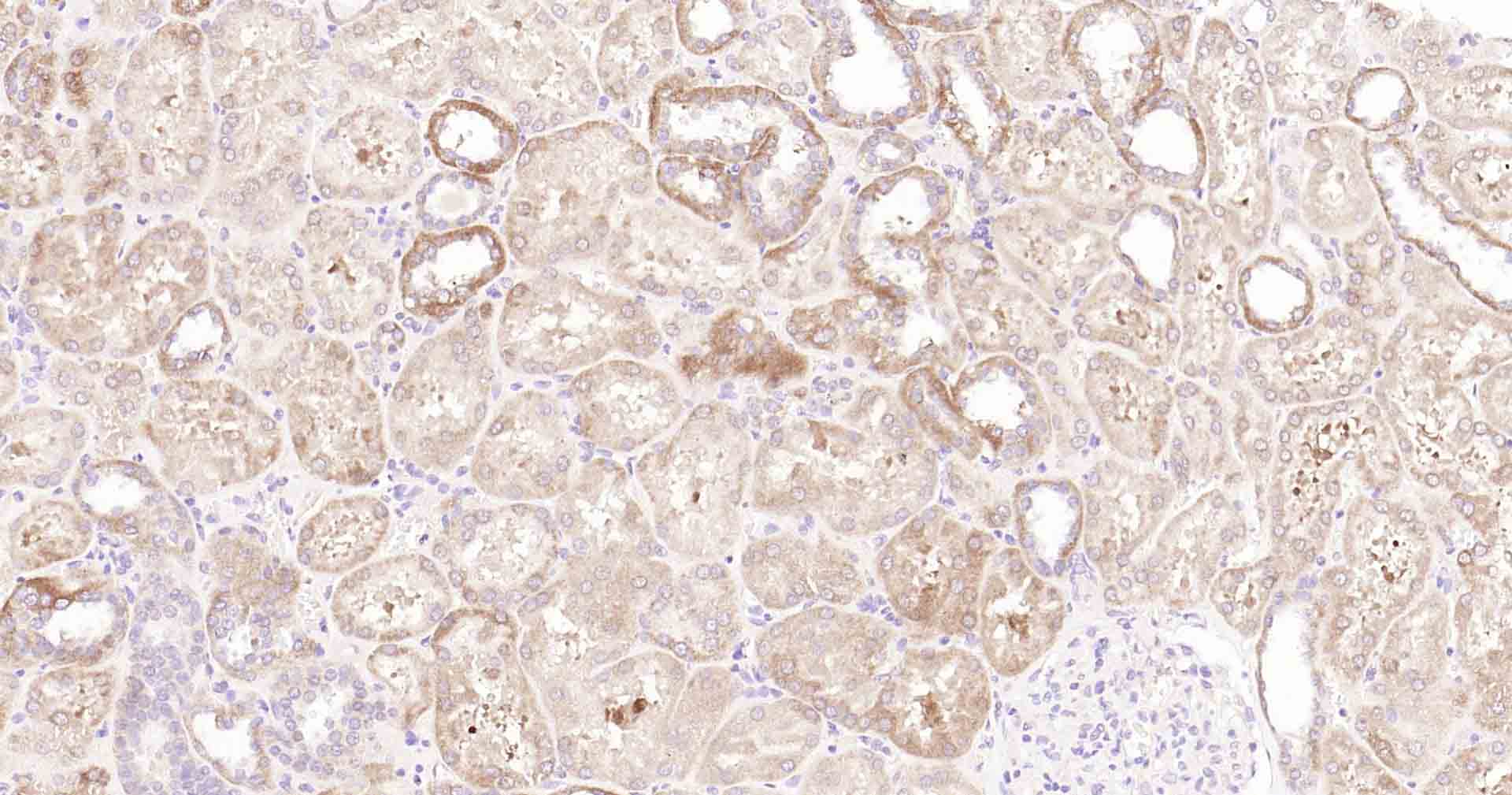 自噬效应蛋白Beclin 1重组兔单抗