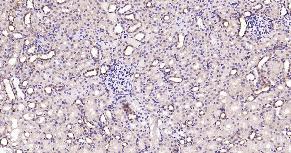 钙网蛋白重组兔单抗