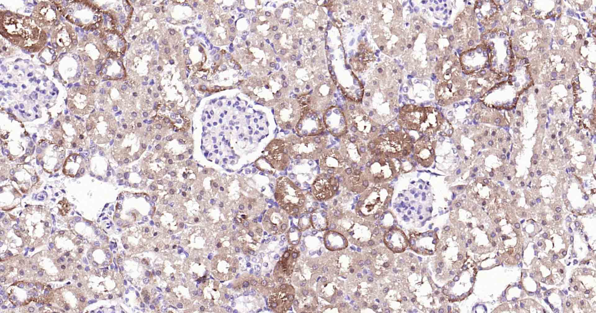 自噬效应蛋白Beclin 1重组兔单抗