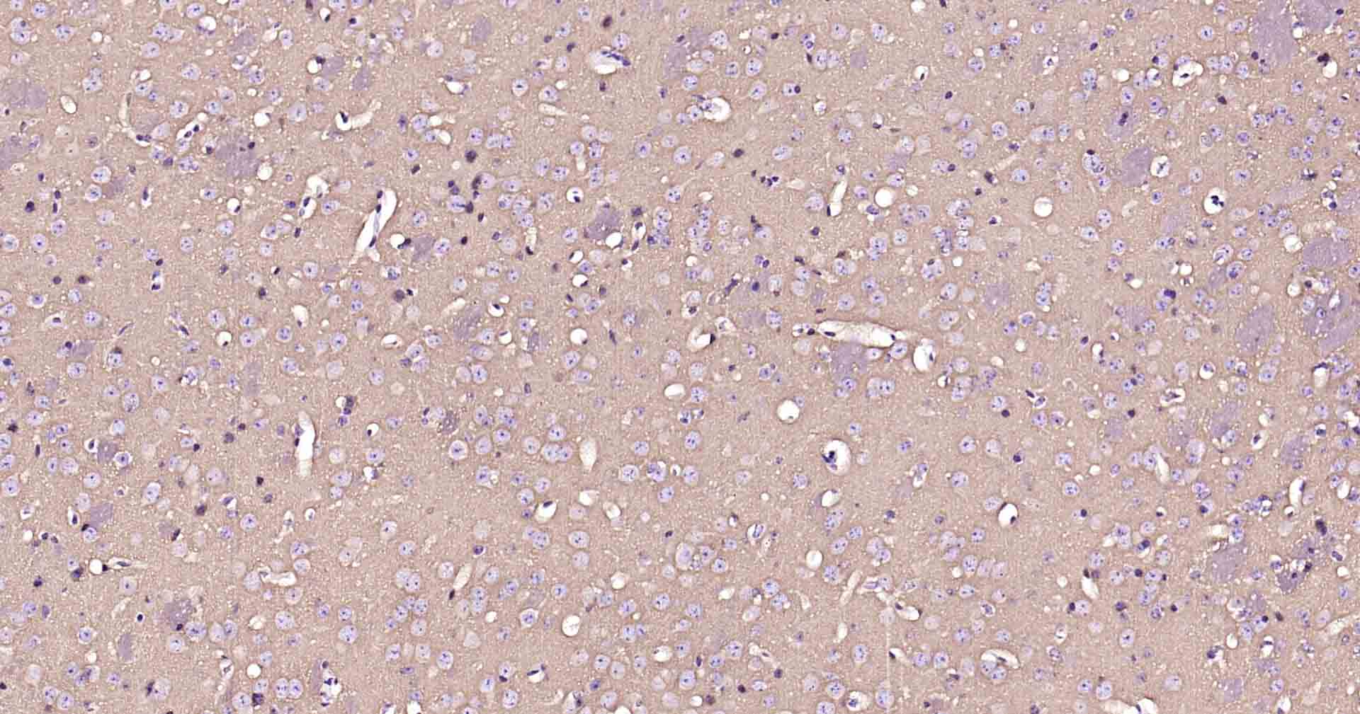 ATP1B1 Recombinant Rabbit mAb (一抗) - IHC-P,IHC-F,IF | Bioss