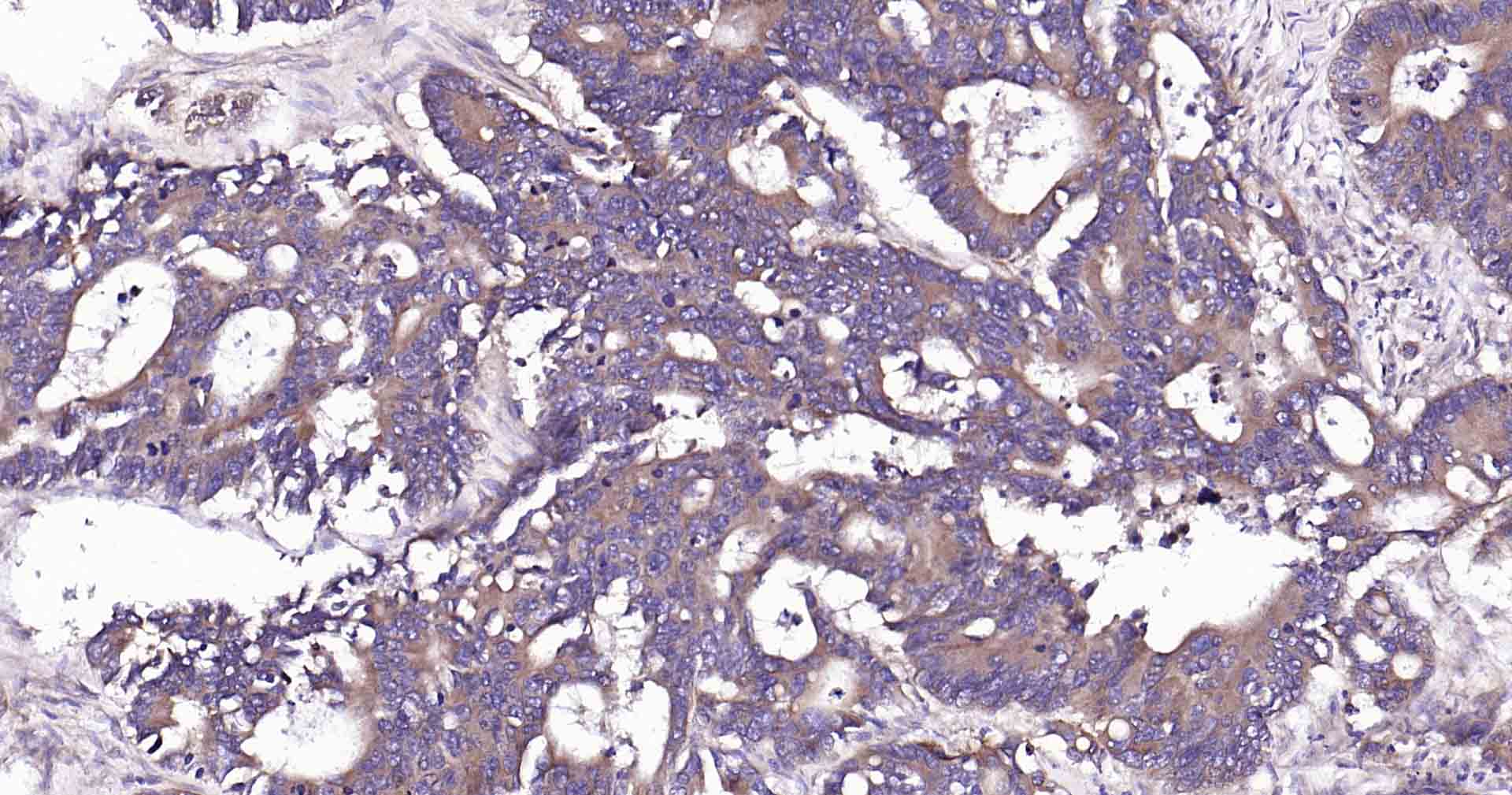 Ras样蛋白A重组兔单抗