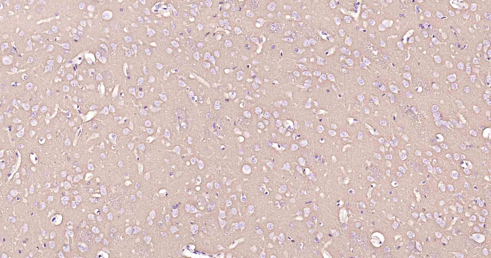 钠钾ATP酶蛋白b1重组兔单抗-bsm-61065R