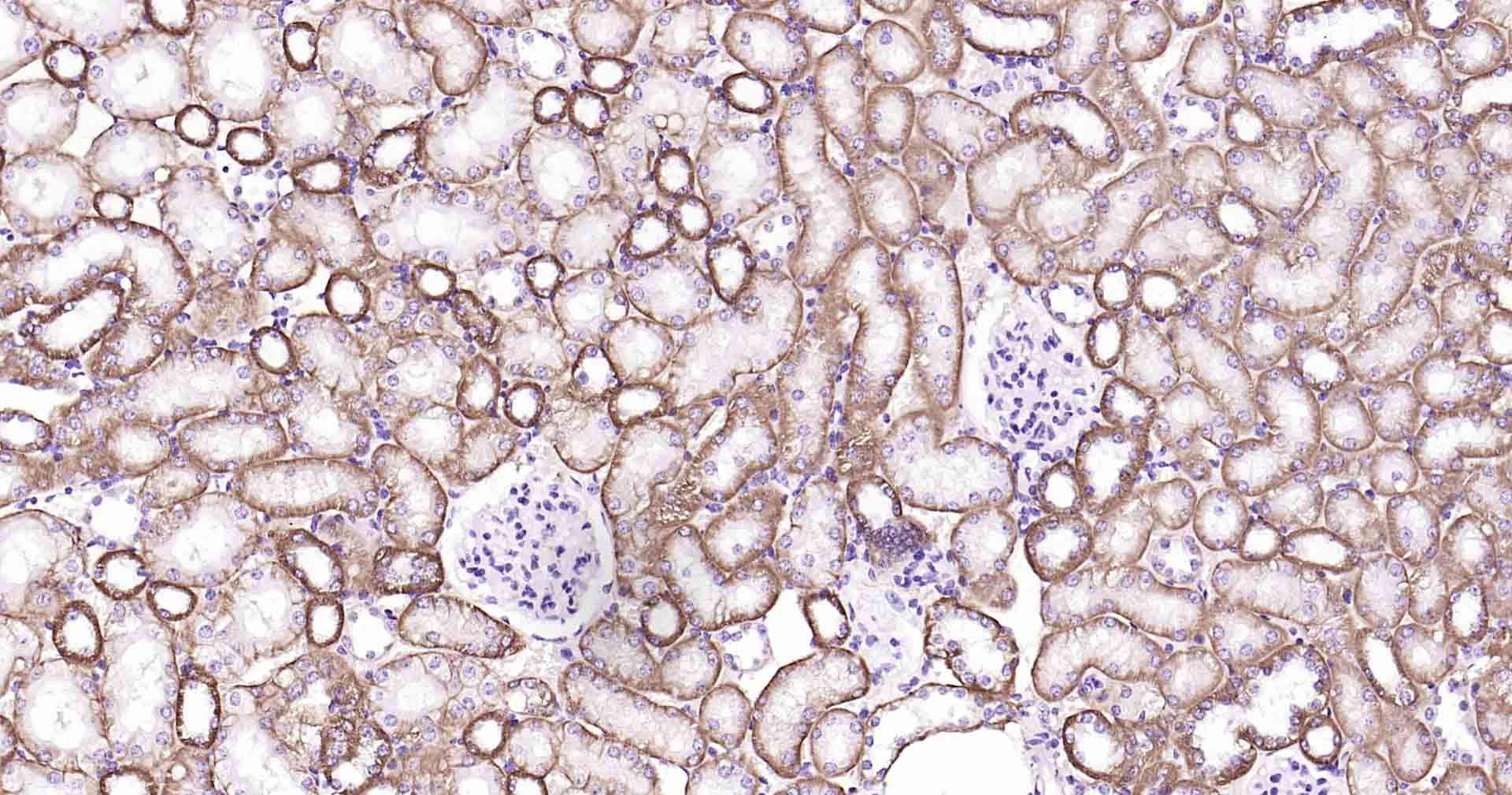 钠钾ATP酶蛋白b1重组兔单抗-bsm-61065R