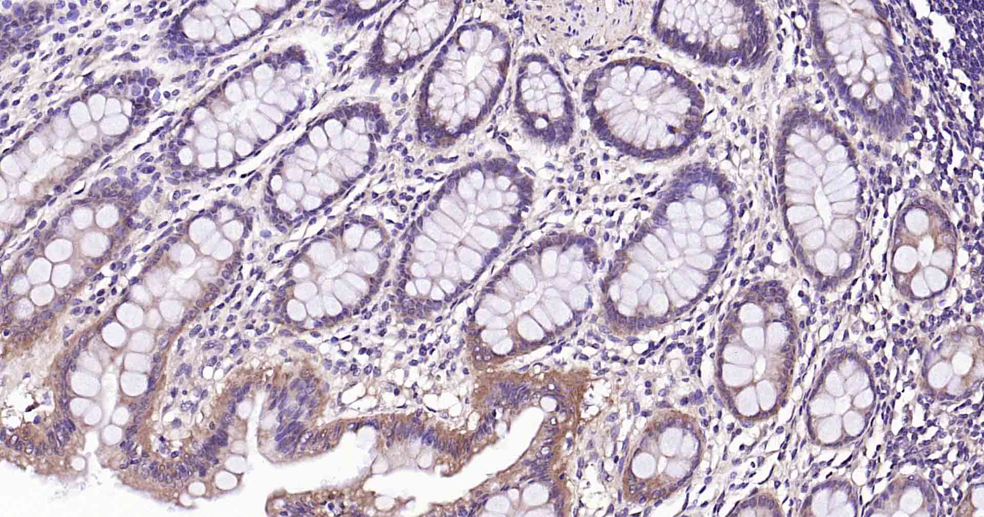 Ras样蛋白A重组兔单抗
