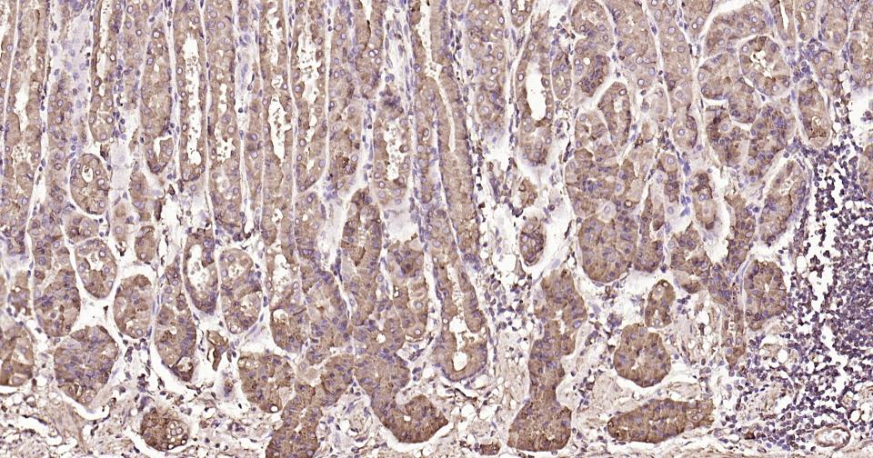 钙网蛋白重组兔单抗