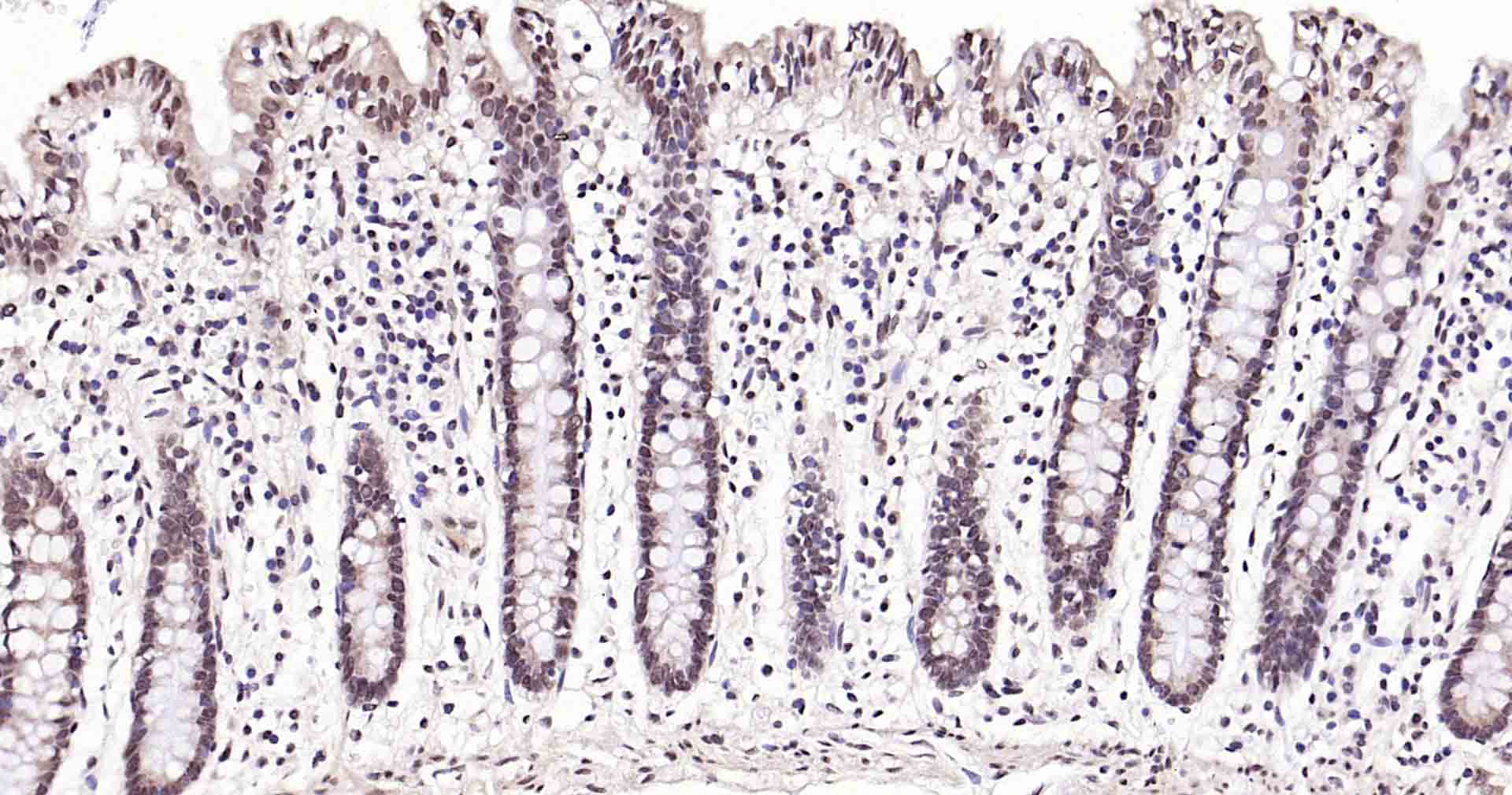 磷脂酰肌醇激酶（PI3Kβ）重组兔单抗