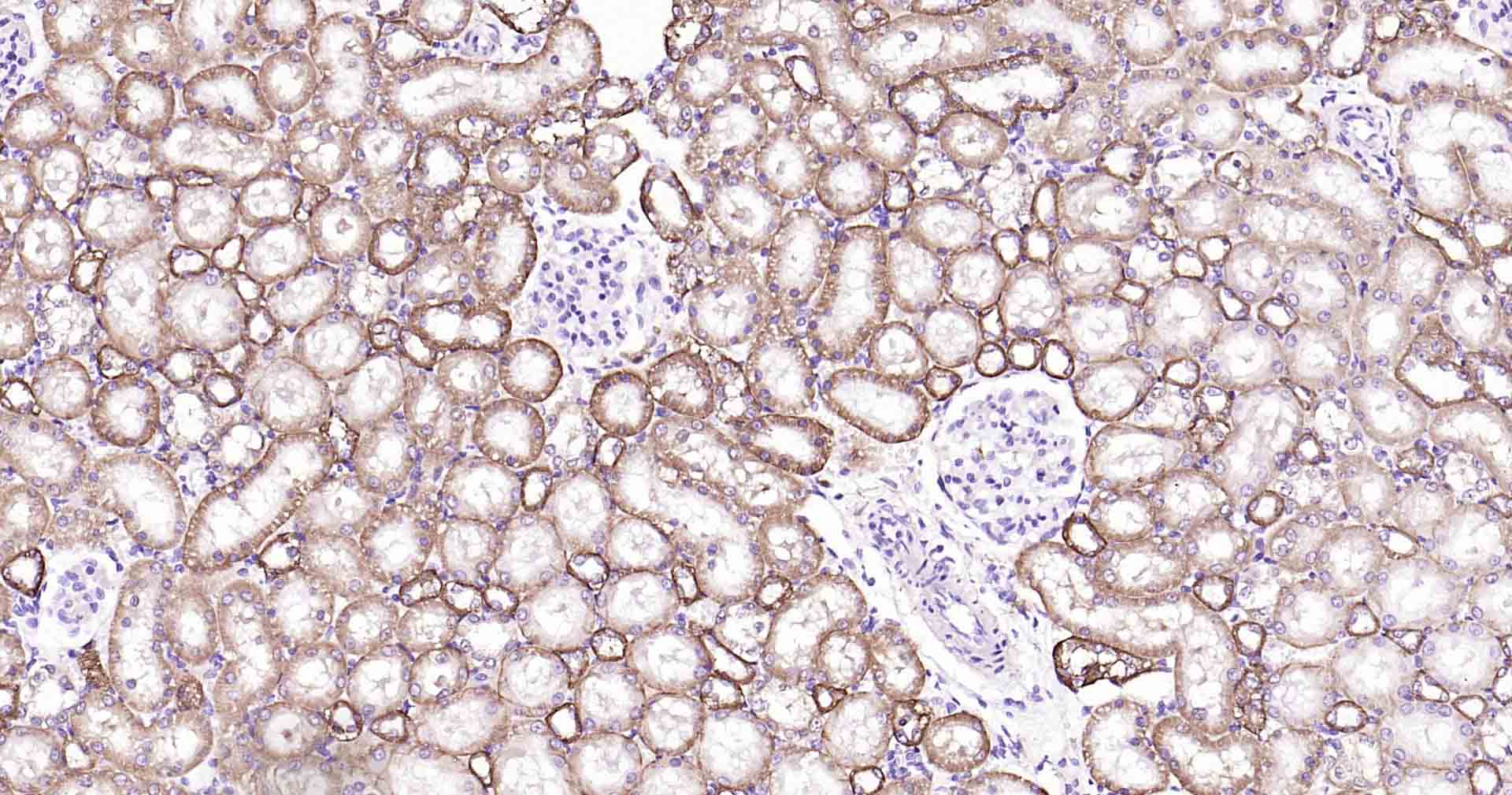 钠钾ATP酶蛋白b1重组兔单抗-bsm-61065R