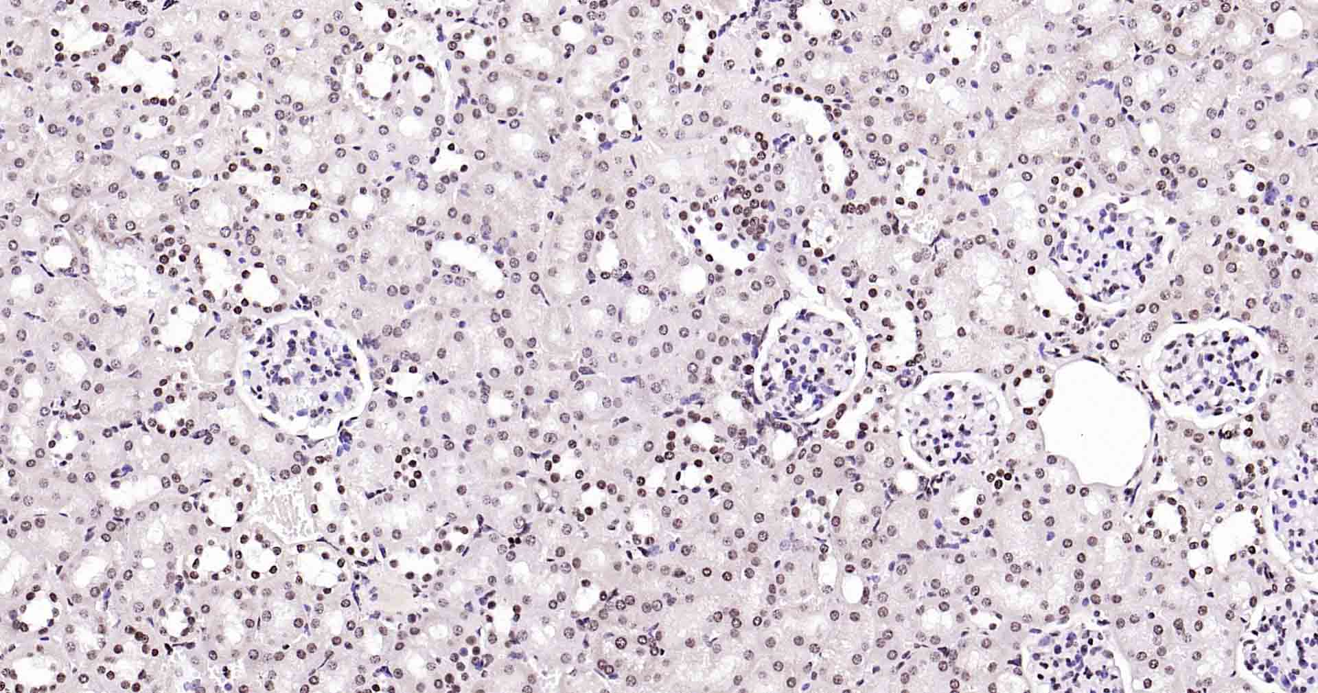 Rad51重组兔单抗