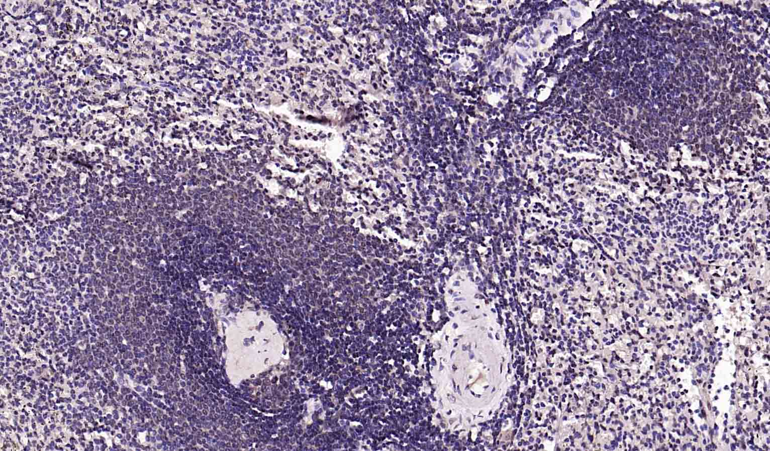 磷脂酰肌醇激酶（PI3Kβ）重组兔单抗