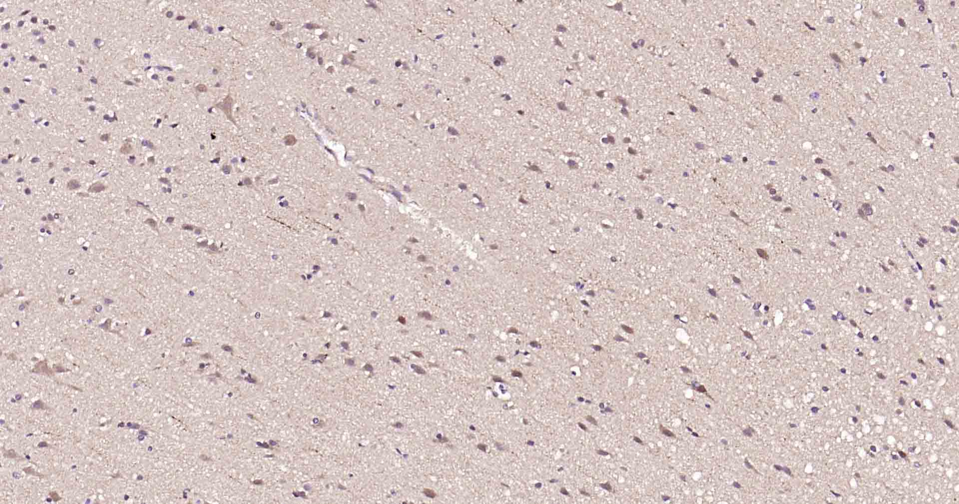 自噬效应蛋白Beclin 1重组兔单抗