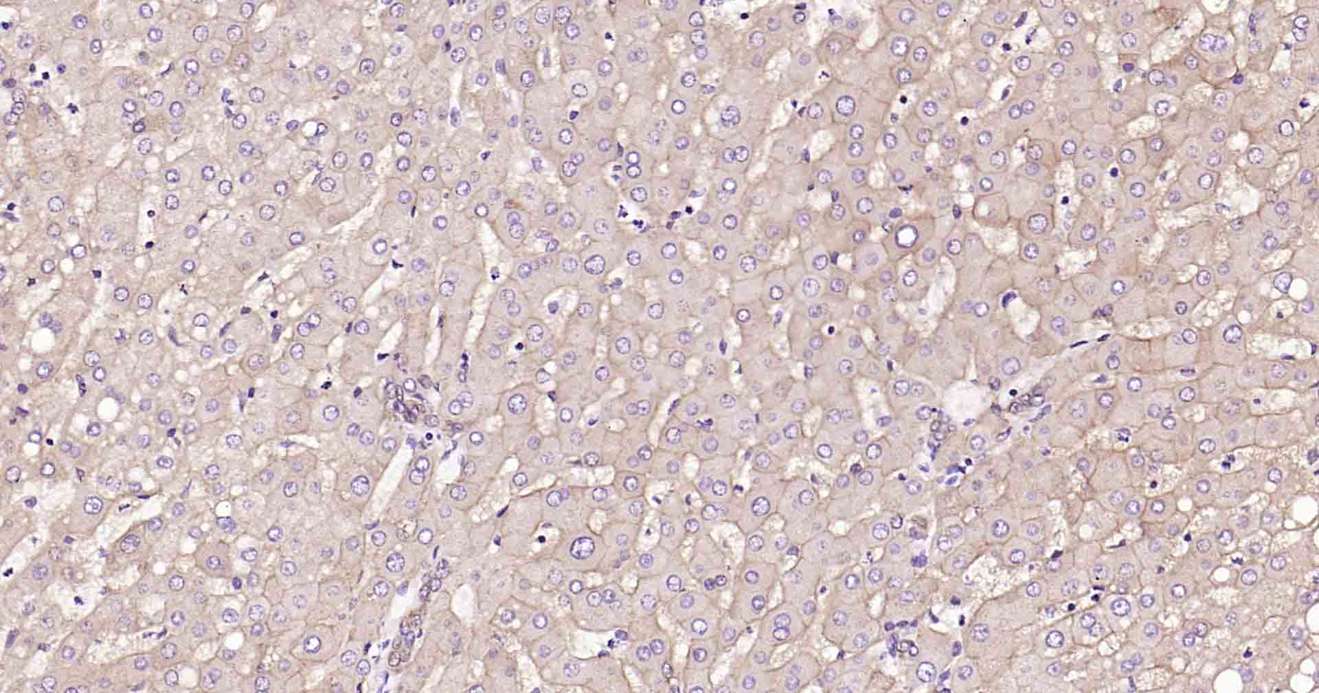 钠钾ATP酶蛋白b1重组兔单抗-bsm-61065R