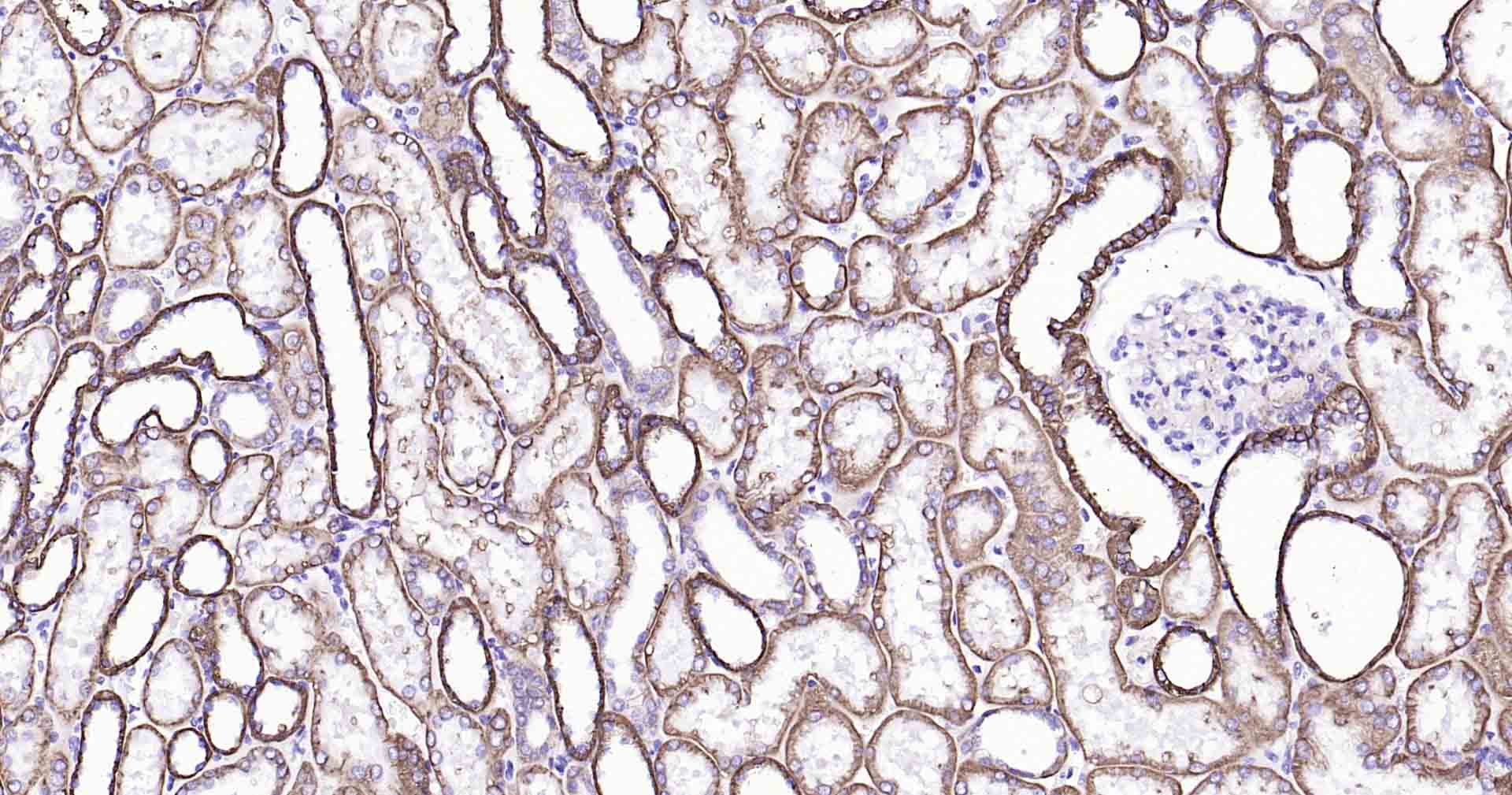 钠钾ATP酶蛋白a1单克隆抗体-bsm-34014M