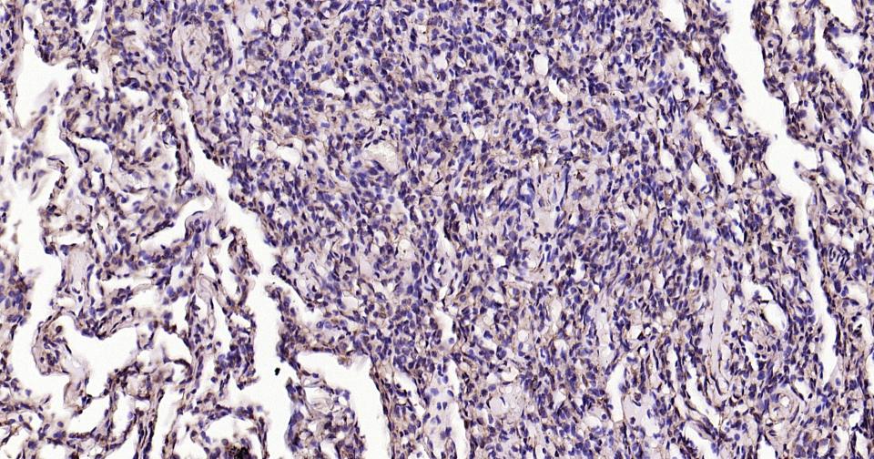 钙网蛋白重组兔单抗