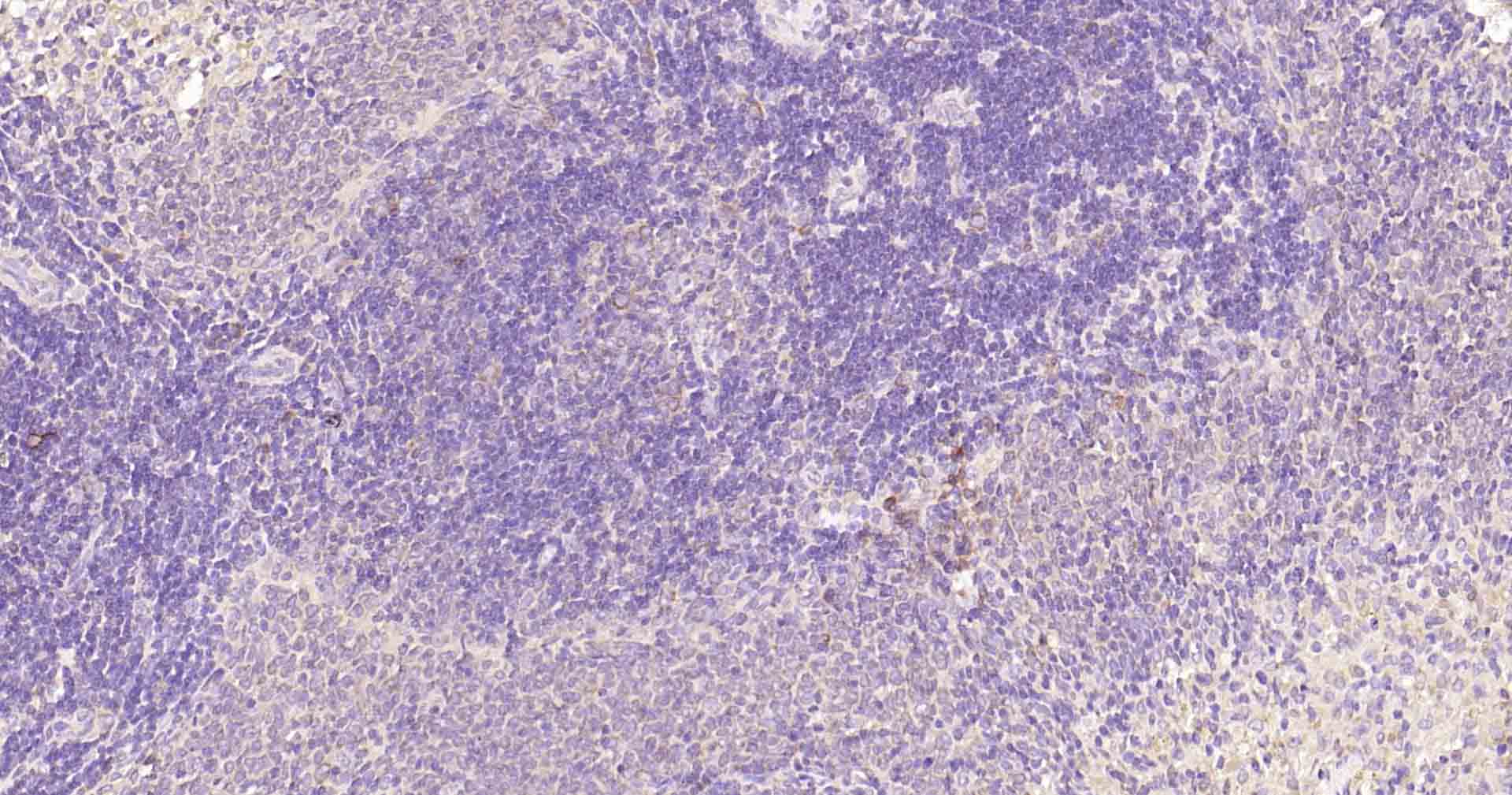 自噬效应蛋白Beclin 1重组兔单抗