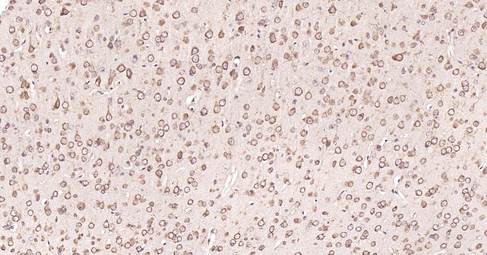 钙网蛋白重组兔单抗