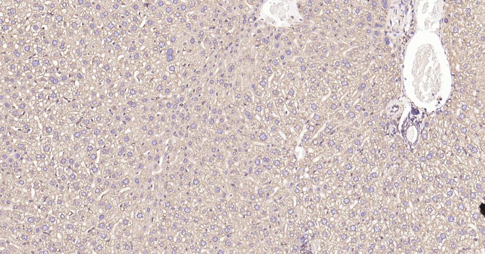 钙网蛋白重组兔单抗