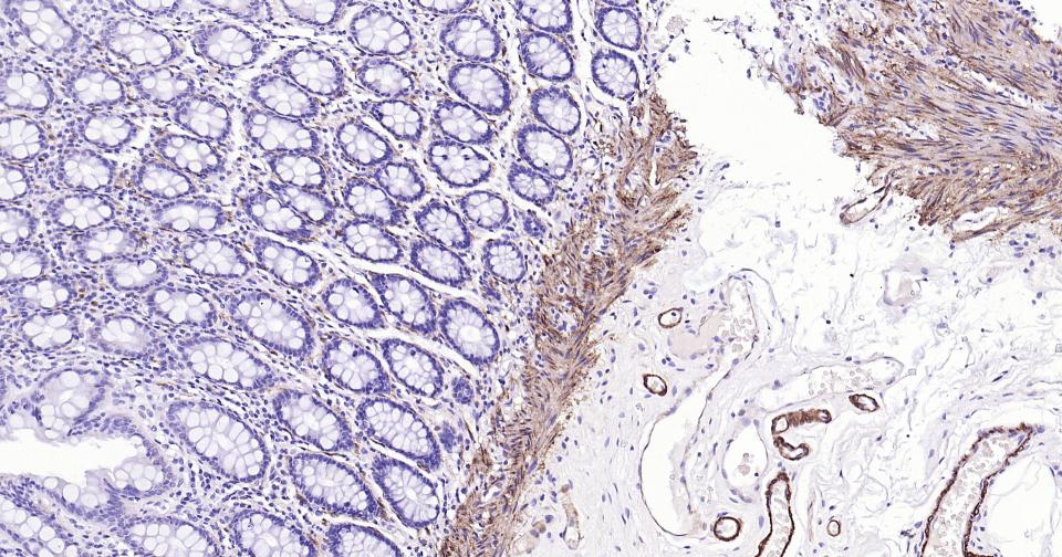 钙调节蛋白-1重组兔单克隆抗体