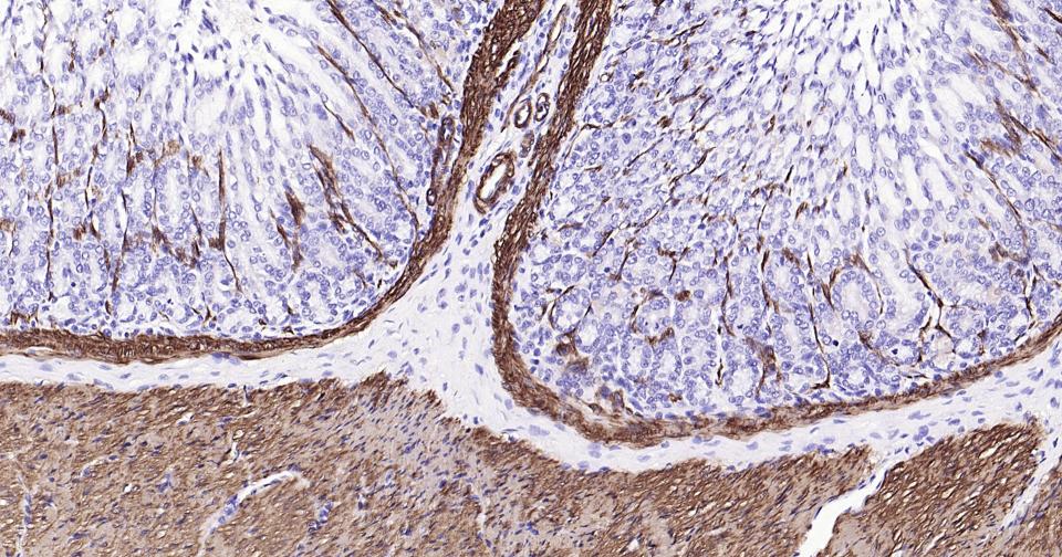 钙调节蛋白-1重组兔单克隆抗体