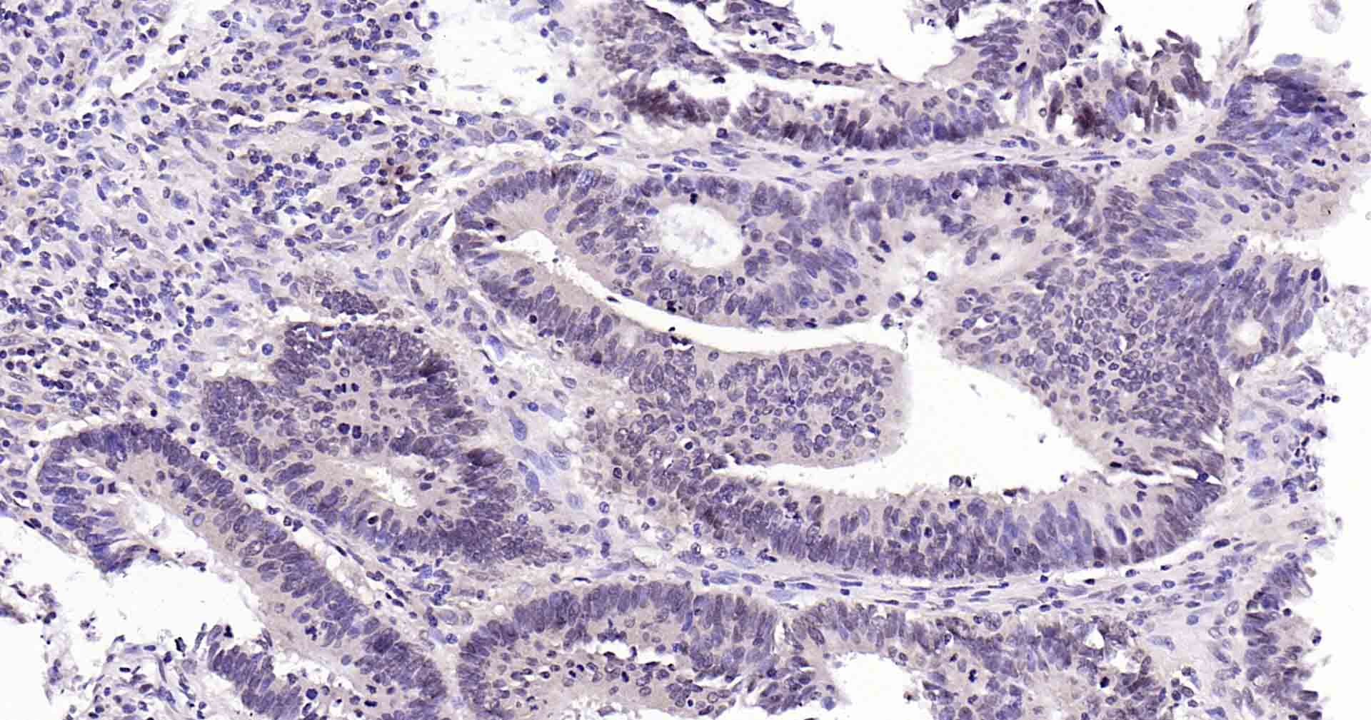 Rad51重组兔单抗