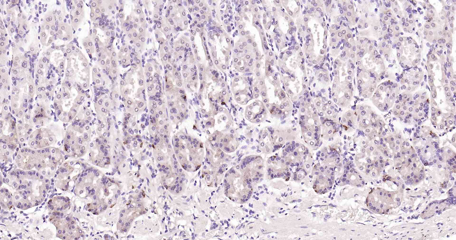 自噬效应蛋白Beclin 1重组兔单抗