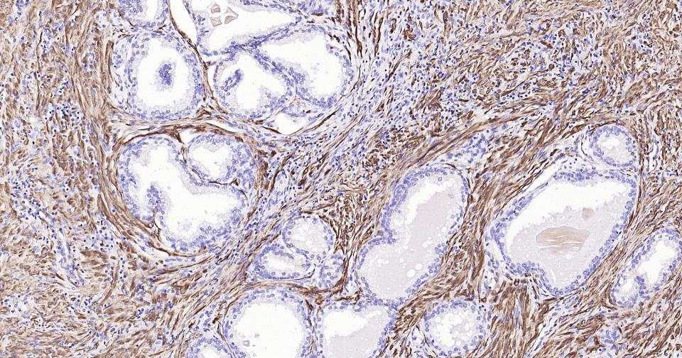 钙调节蛋白-1重组兔单克隆抗体