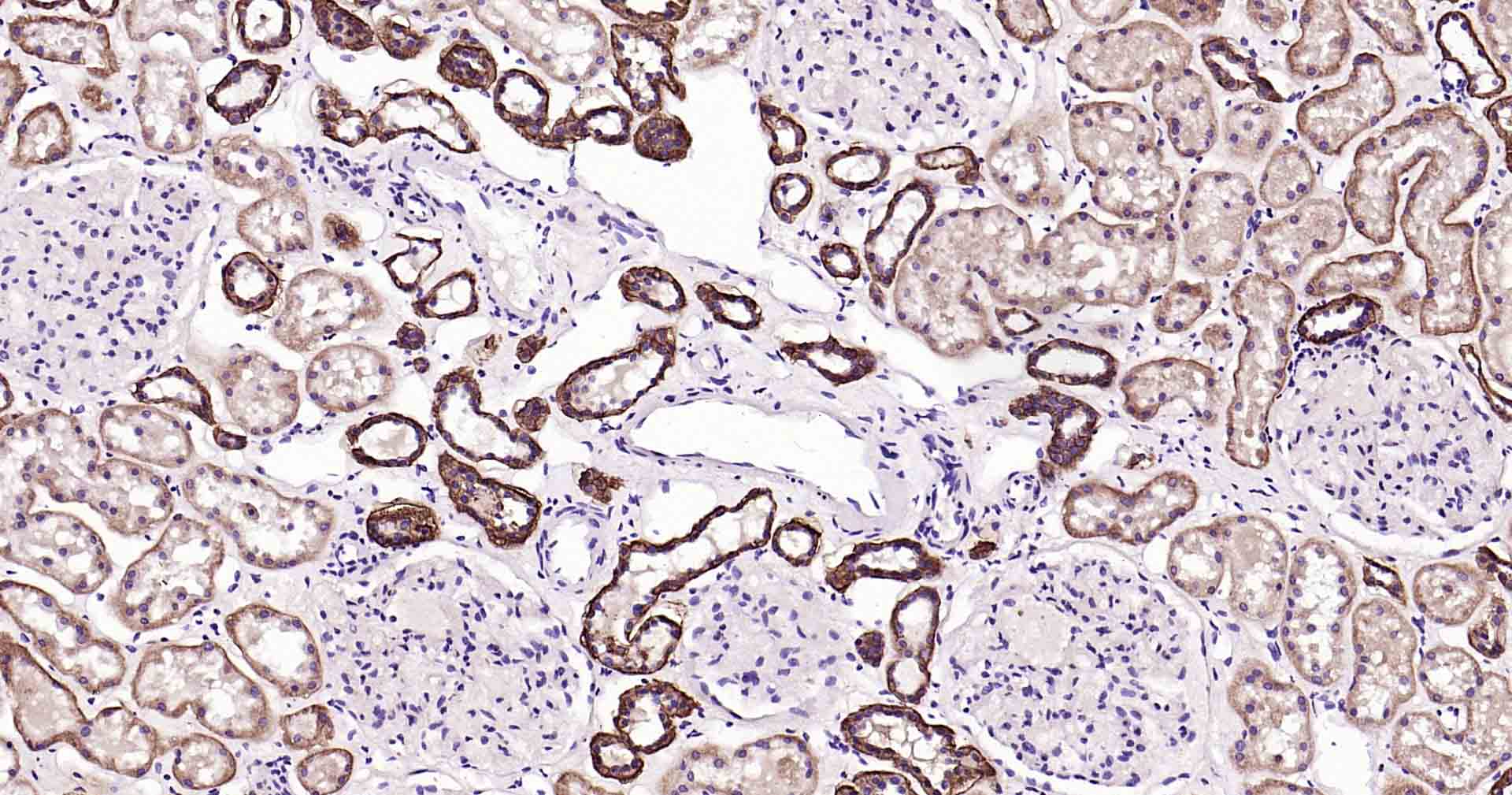 钠钾ATP酶蛋白b1重组兔单抗-bsm-61065R