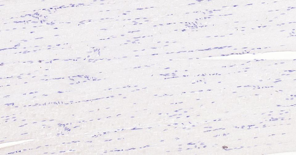 糖蛋白gp330重组兔单抗