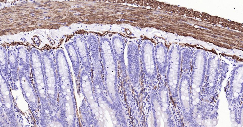 钙调节蛋白-1重组兔单克隆抗体