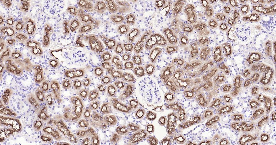 糖蛋白gp330重组兔单抗