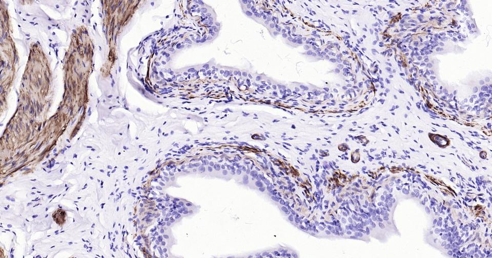 钙调节蛋白-1重组兔单克隆抗体
