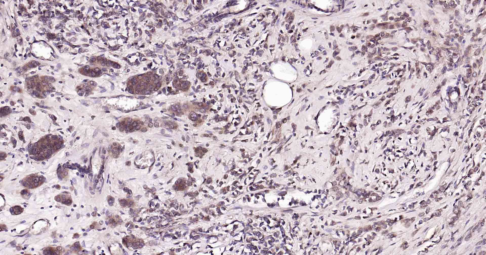 Ras样蛋白A重组兔单抗