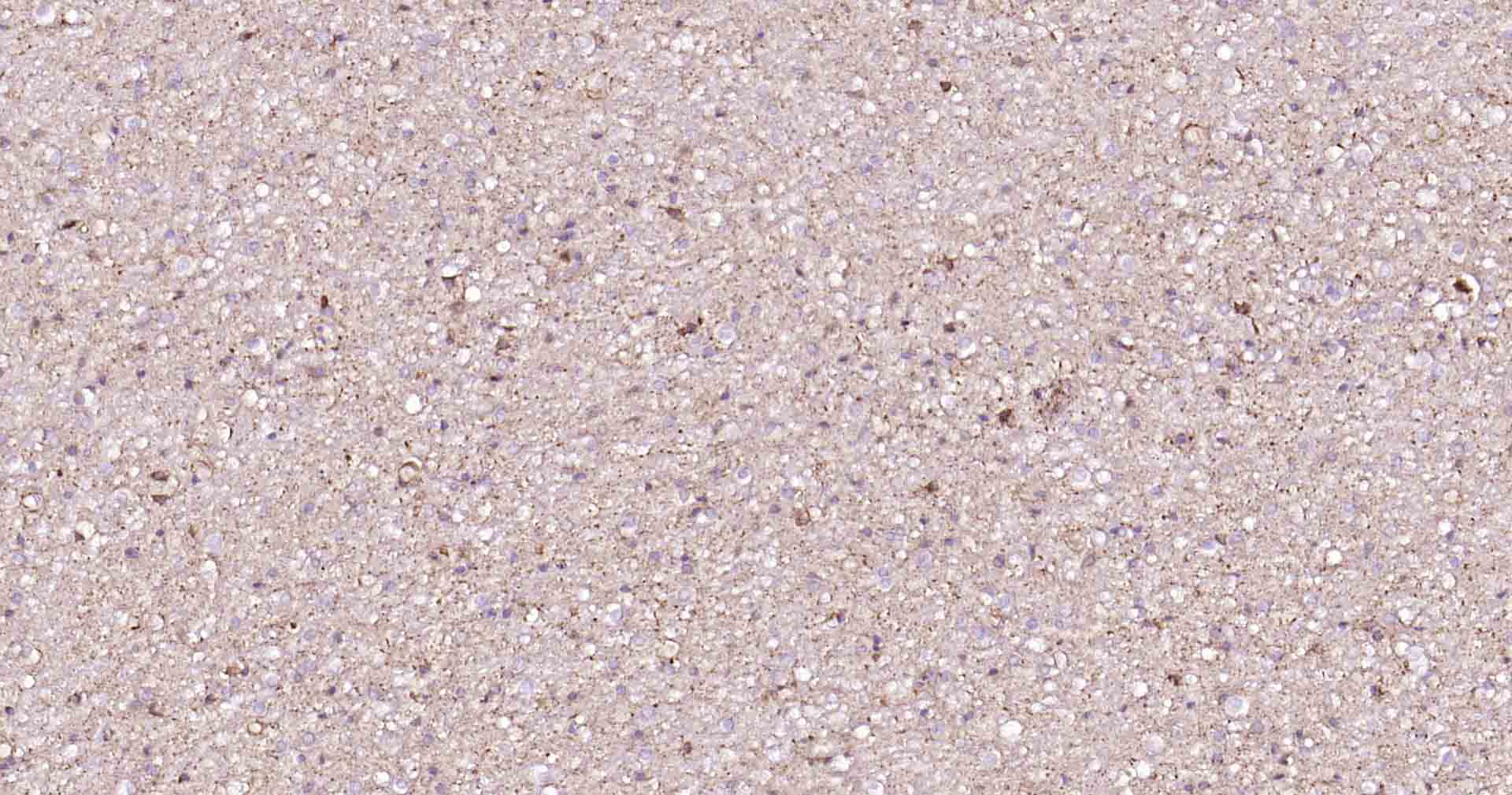 神经元特异性烯醇化酶/γ 烯醇化酶重组兔单克隆抗体