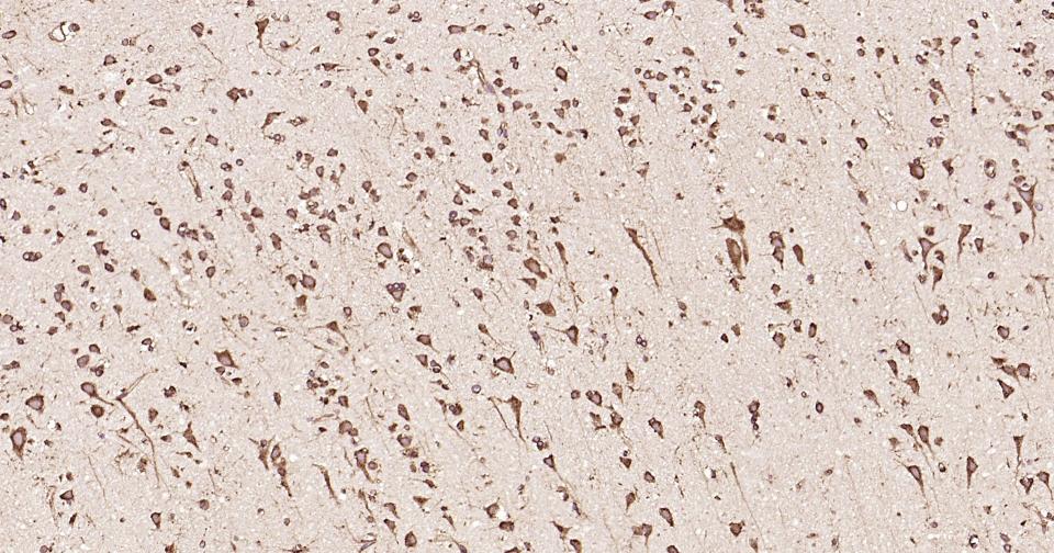 钙网蛋白重组兔单抗