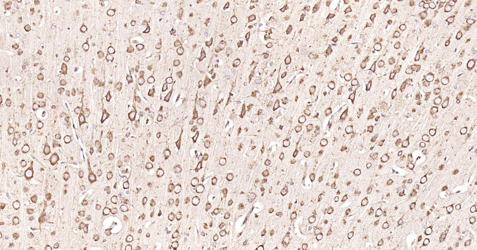 钙网蛋白重组兔单抗