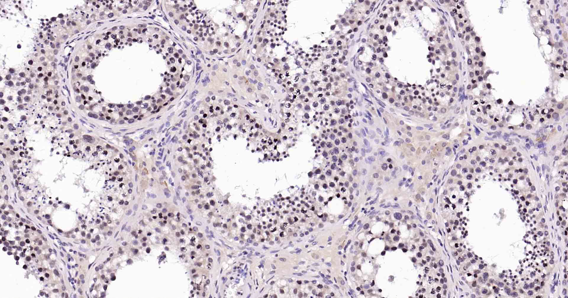Rad51重组兔单抗