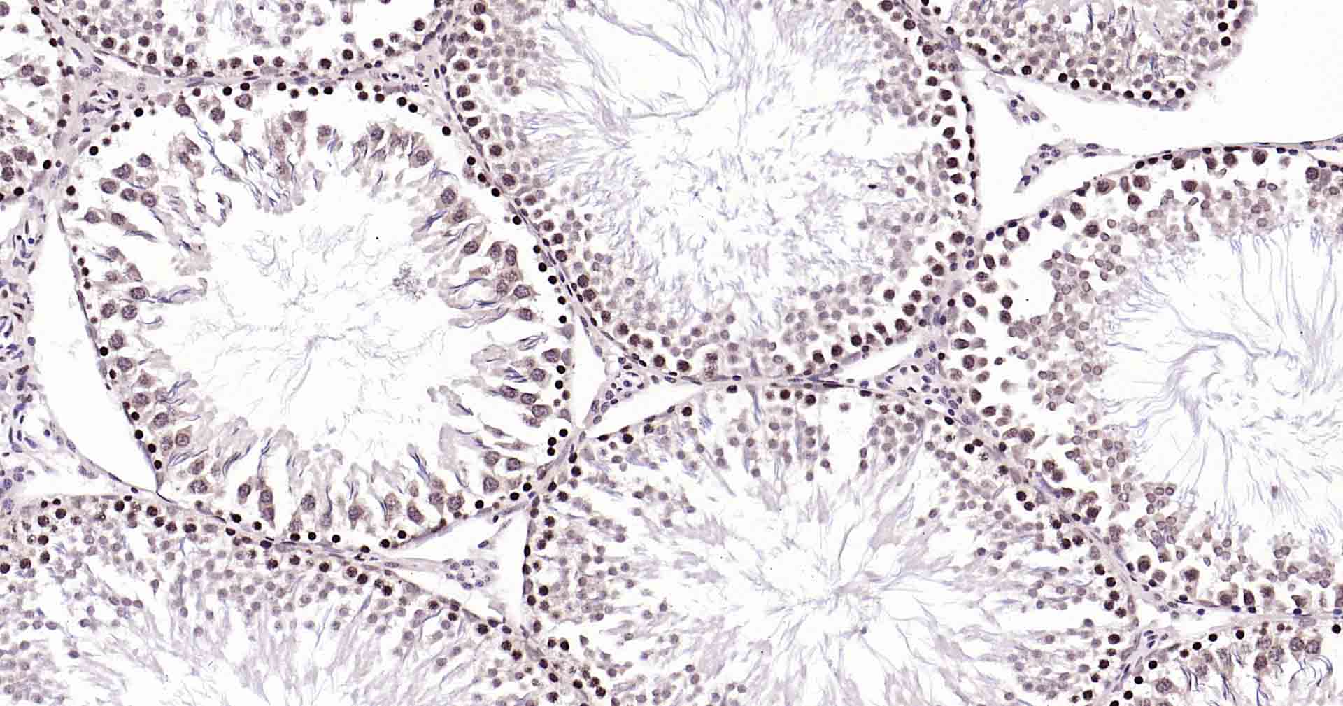 Rad51重组兔单抗