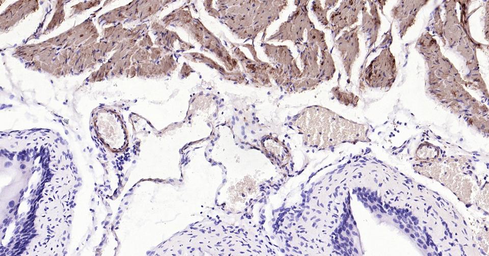 钙调节蛋白-1重组兔单克隆抗体