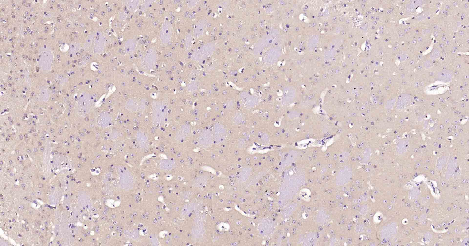 神经元特异性烯醇化酶/γ 烯醇化酶重组兔单克隆抗体