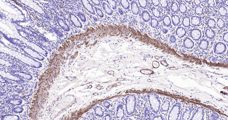 钙调节蛋白-1重组兔单克隆抗体