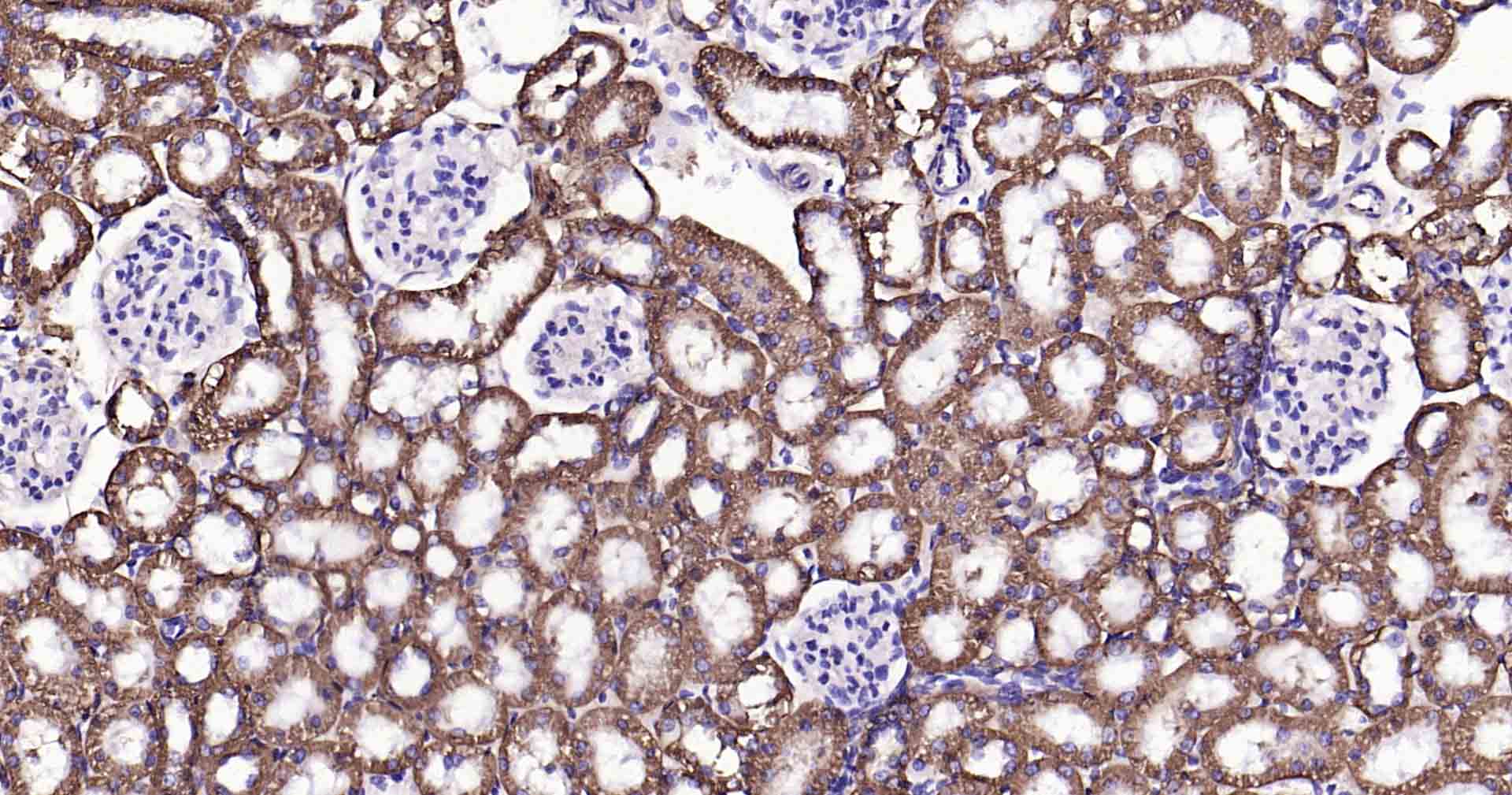钠钾ATP酶蛋白a1单克隆抗体-bsm-34014M