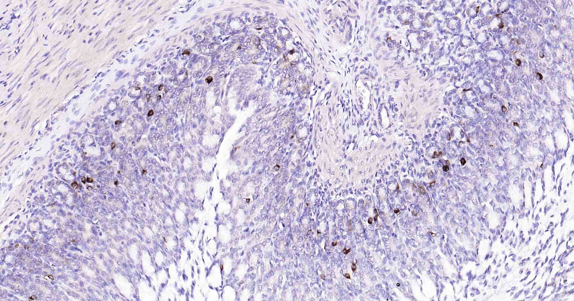 自噬效应蛋白Beclin 1重组兔单抗