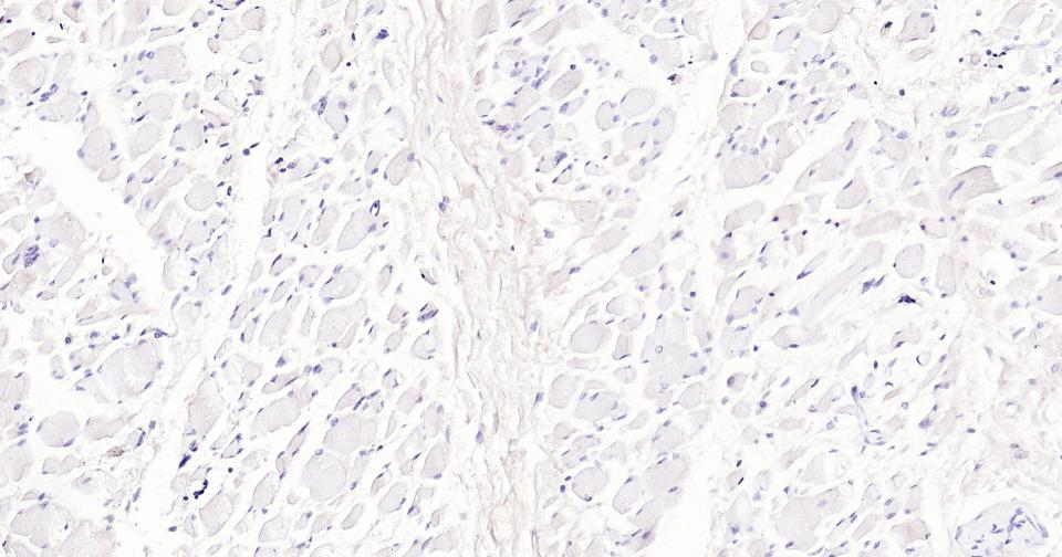 糖蛋白gp330重组兔单抗