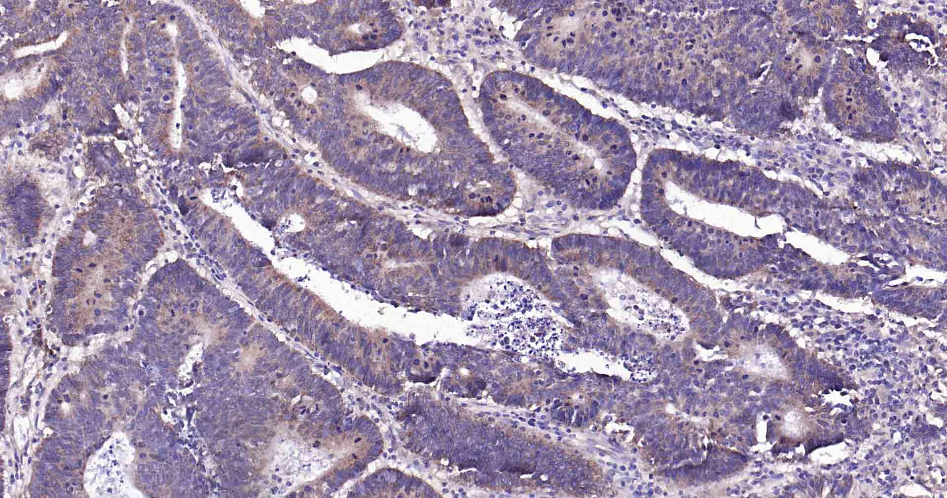 自噬效应蛋白Beclin 1重组兔单抗