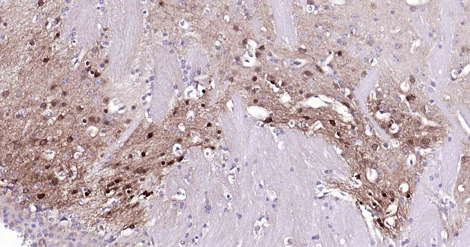 自噬效应蛋白Beclin 1重组兔单抗