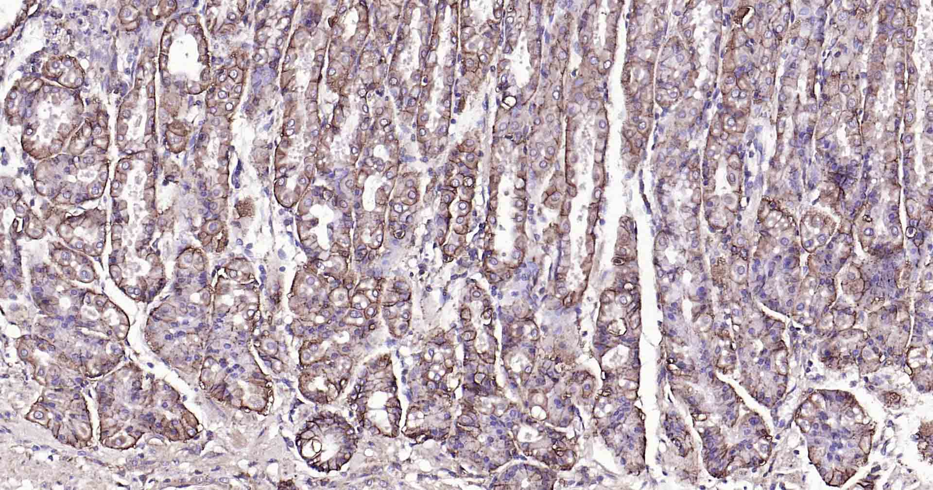 钠钾ATP酶蛋白a1单克隆抗体-bsm-34014M