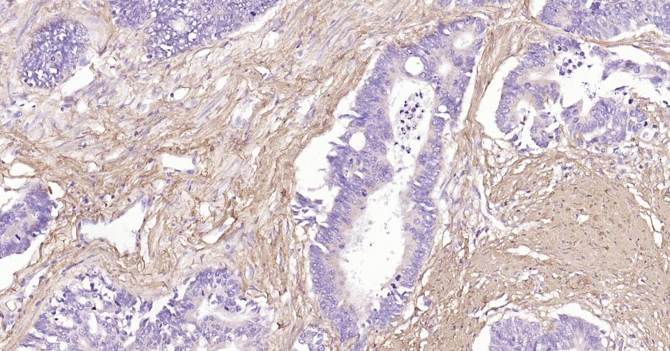 Collagen I Mouse mAb (一抗) - IHC-P,IHC-F,IF | Bioss