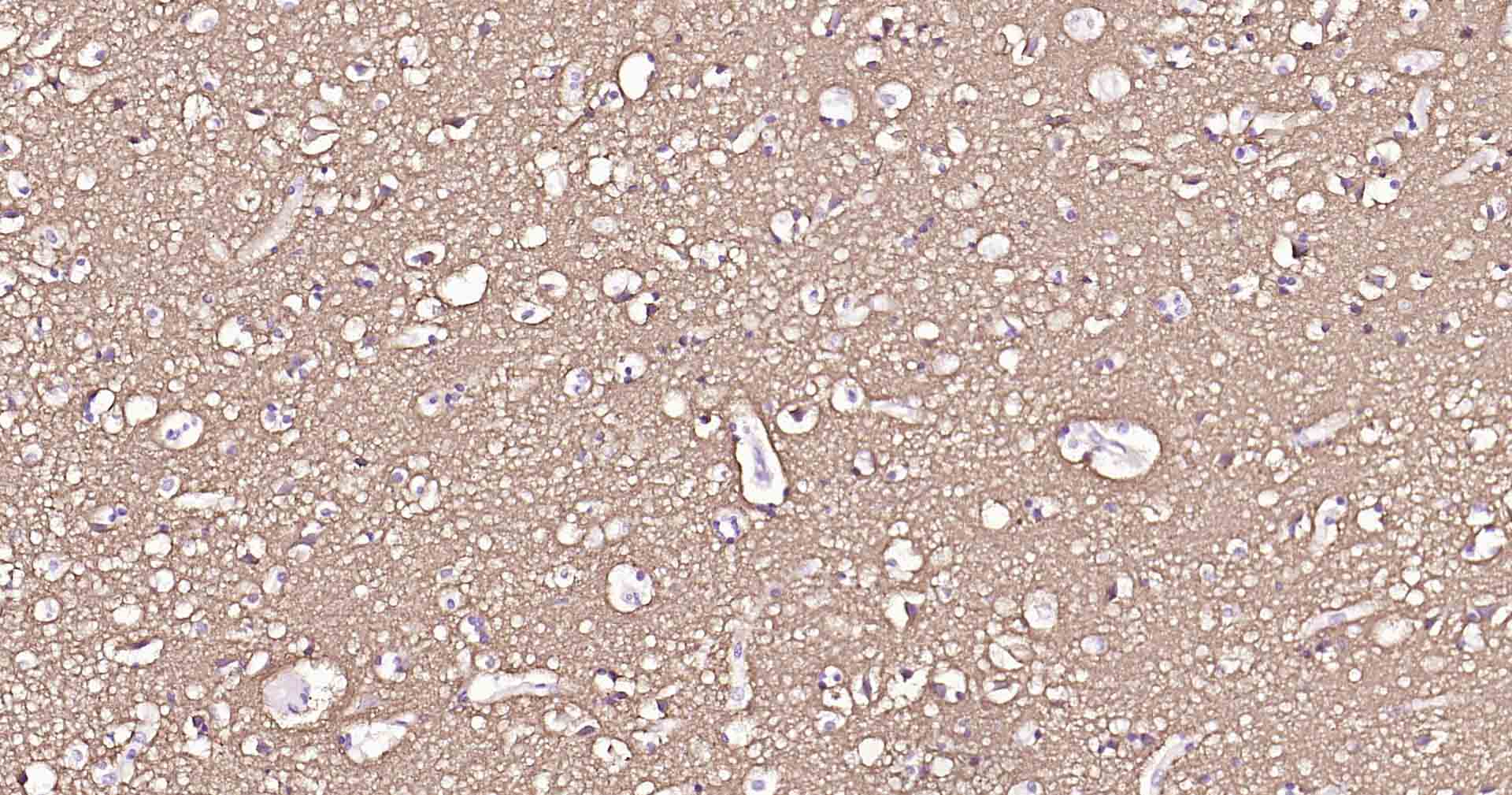 钠钾ATP酶蛋白b1重组兔单抗-bsm-61065R